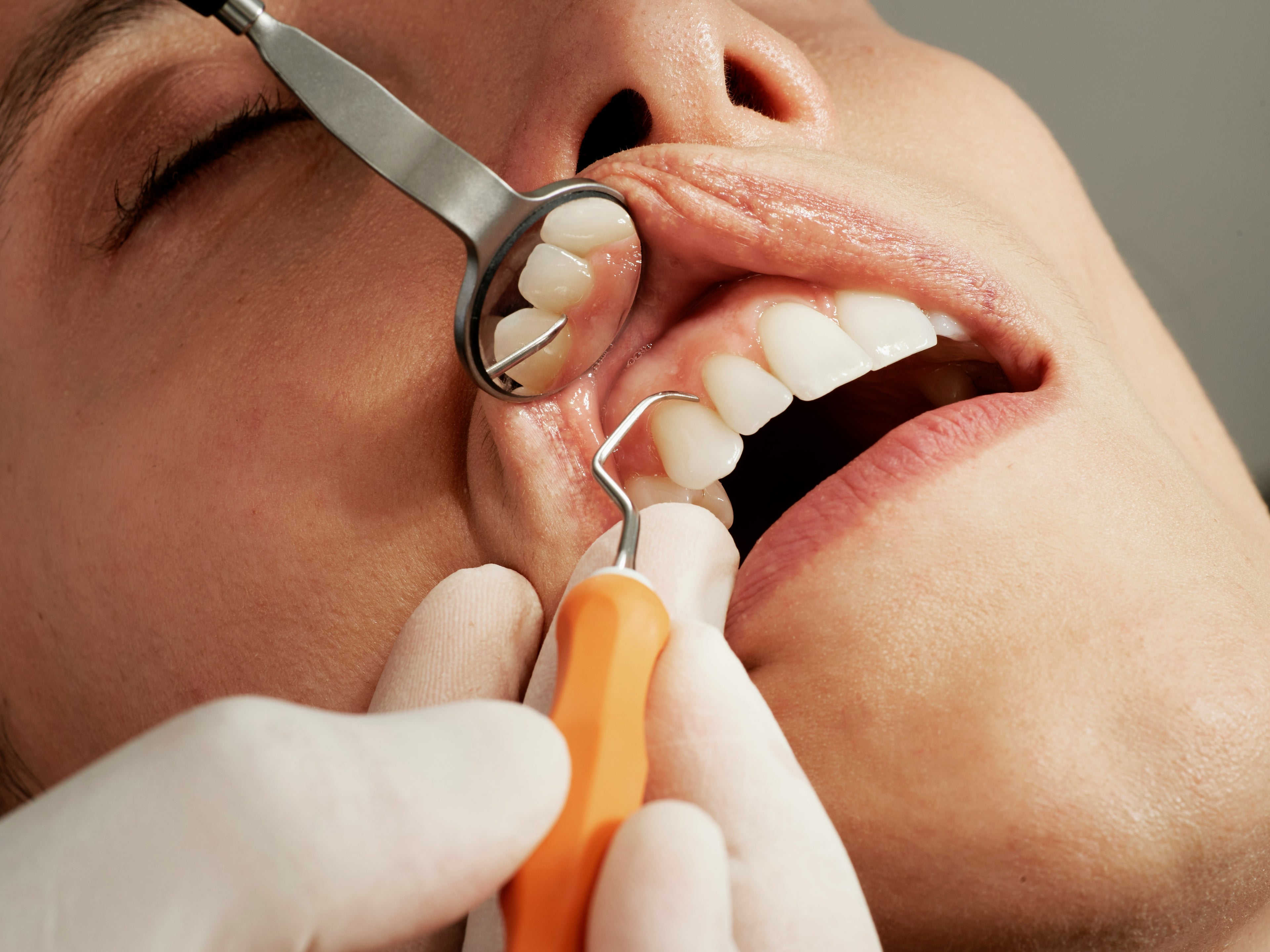 Endodontic Treatments