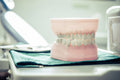 Full-Arch Zirconia Restorations