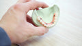 All-on-4 Dental Implants (Full-Arch Restoration)
